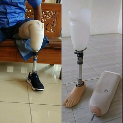 Kaki palsu bawah lutut menggunakan doble soket silicon dan pinlock, sangat cocok untuk penderita diabetes