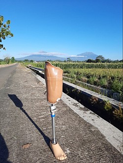 Kaki palsu atas lutut soket lentur sistem vaccum tanpa perlu sabuk,