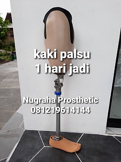 Kaki palsu atas lutut, ada beberapa pilihan jenis parts dan soket, soket standar dobel busa juga soket lentur dengan flexible resin