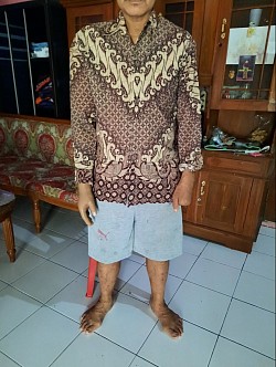 Tangan palsu bahu