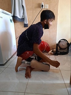 Kaki palsu sejak lahir