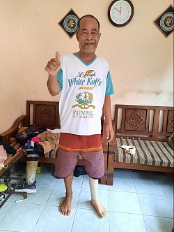 penyerahan kaki palsu gratis wilayah magelang