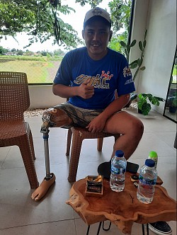 kaki palsu atas lutut jogja