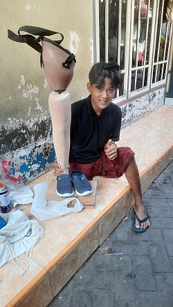 penyerahan kaki palsu atas lutut gratis wilayah surabaya