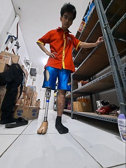 fitting kaki palsu tepat lutut wilayah bekasi