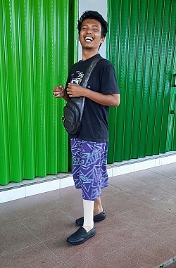 penyerahan sumbangan kaki palsu wilayah klaten