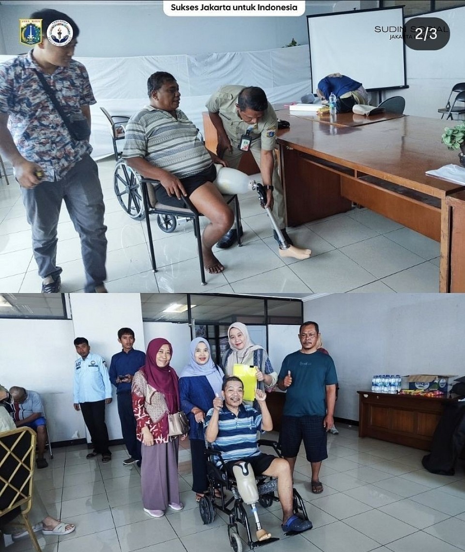 Kaki palsu gratis wilayah jakarta