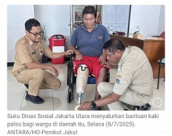 Penyerahan kaki palsu gratis