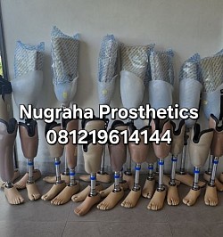 Persiapan penyerahan kaki palsu gratis